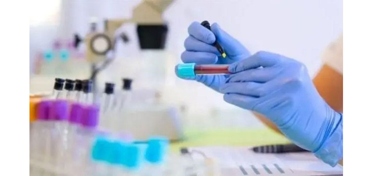 বিশ্বের সবচেয়ে বিরল রক্তের গ্রুপ কোনটি?